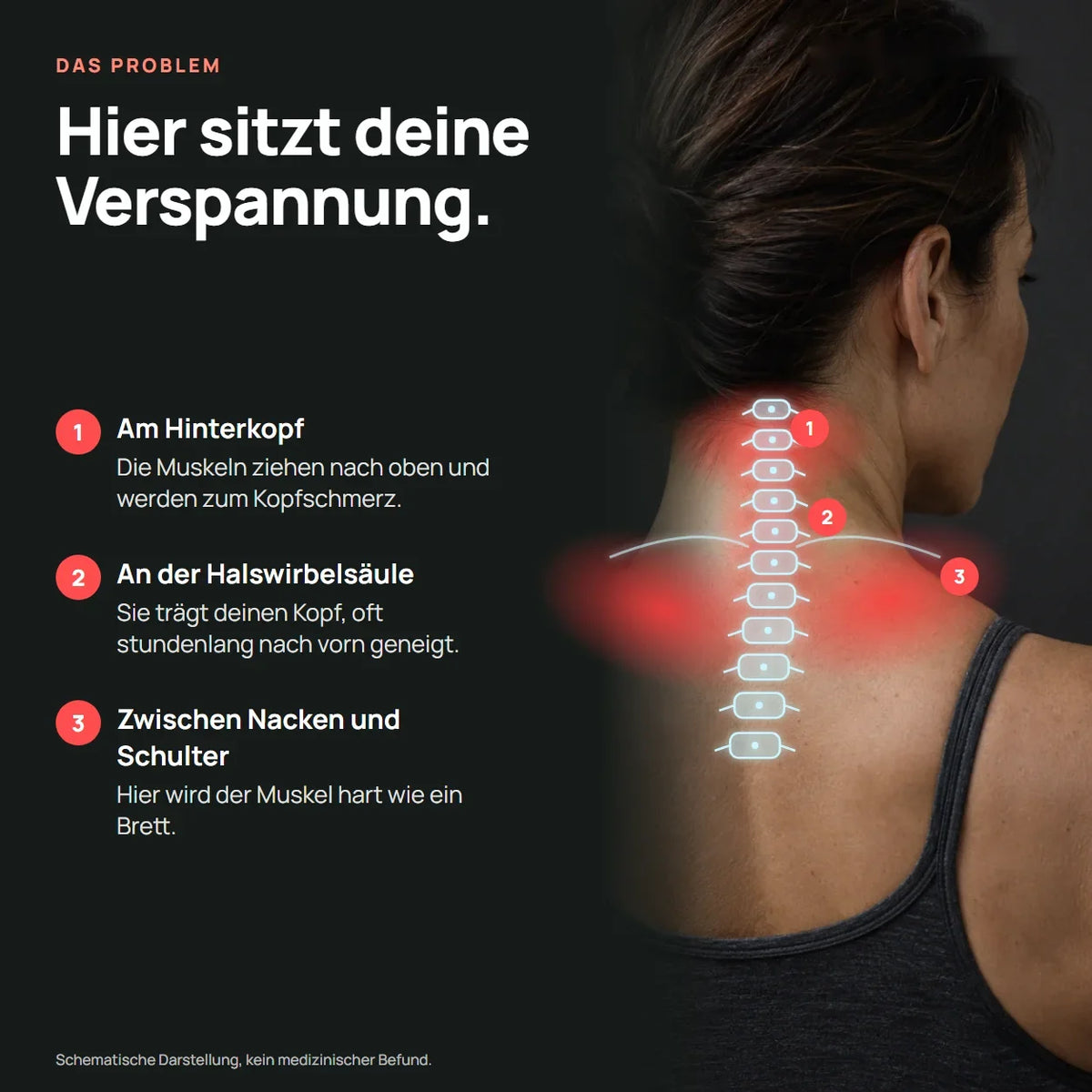 Rücken und Nacken von hinten: Hinterkopf, Halswirbelsäule, Übergang Nacken zu Schulter. Schematisch, kein Befund.